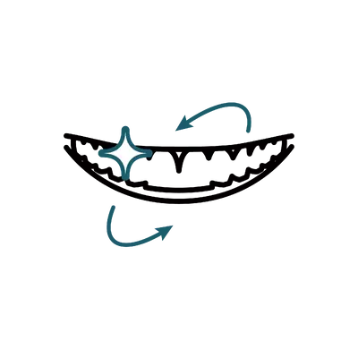 Full Mouth Restoration Package