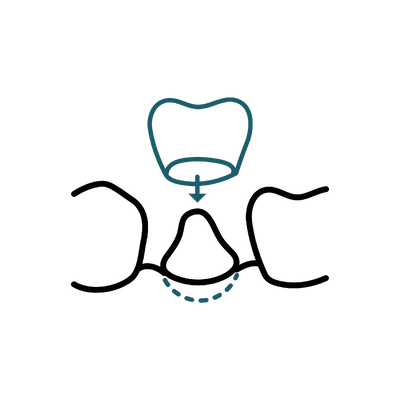 Crown Lengthening in Thailand: Cost, Top Dentists & Hospitals