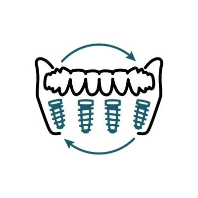 All-on-4 Package in Thailand: Cost, Top Dentists & Hospitals