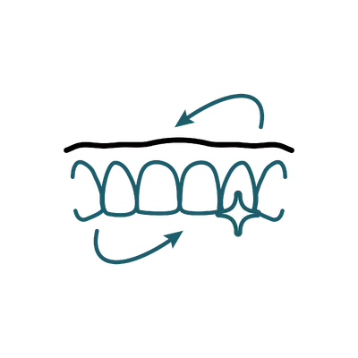 Veneer Package in Thailand: Cost, Top Dentists & Hospitals