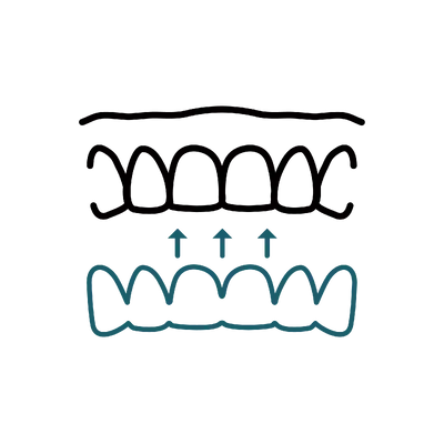 Clear Aligners in Thailand: Cost, Top Dentists & Hospitals