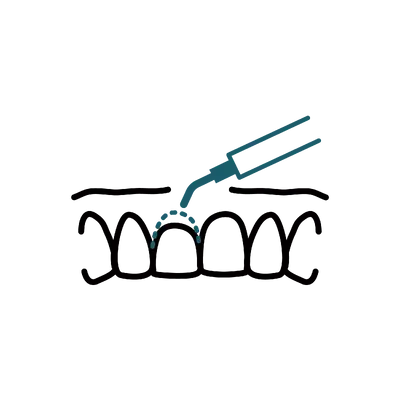 Laser Gum Treatment in Thailand: Cost, Top Dentists & Hospitals