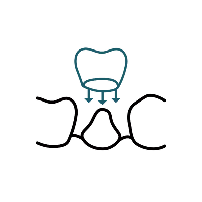 Same-Day Crowns in Thailand: Cost, Top Dentists & Hospitals