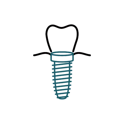 Dental Implants in Thailand: Cost, Top Dentists & Hospitals