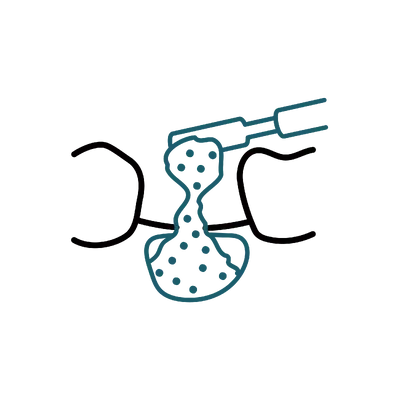 Bone Grafting in Thailand: Cost, Top Dentists & Hospitals