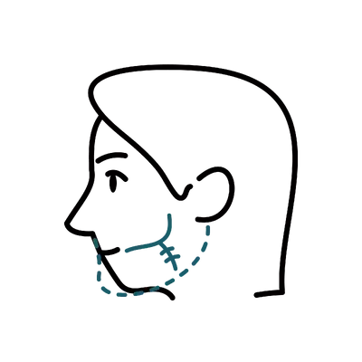 Orthognathic Surgery